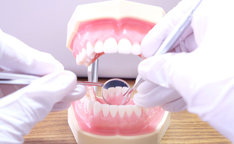 予防歯科について